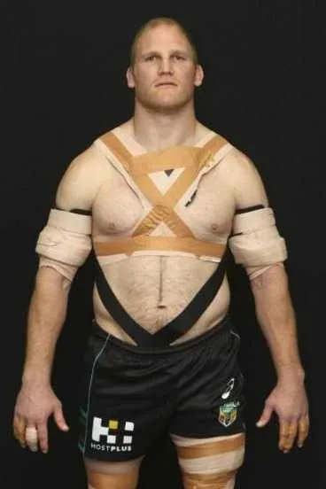 A day in the life of a Rugby Physio — figure 2