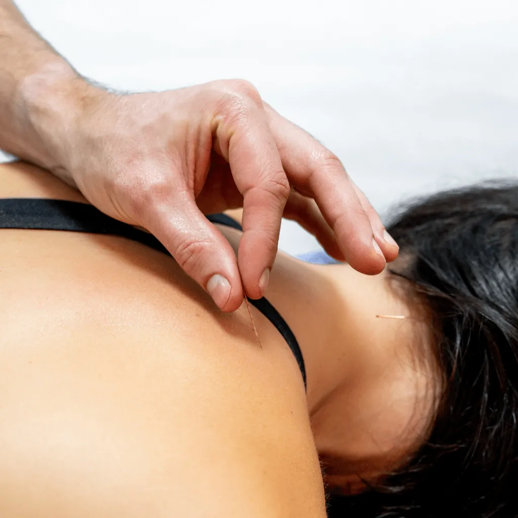 Acupuncture – unlock the benefits! — figure 1