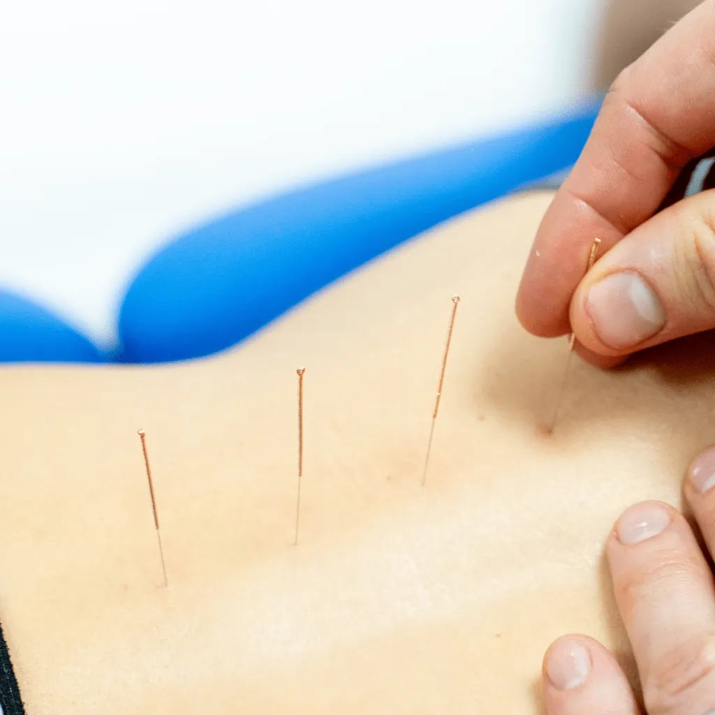Acupuncture – unlock the benefits! — figure 2