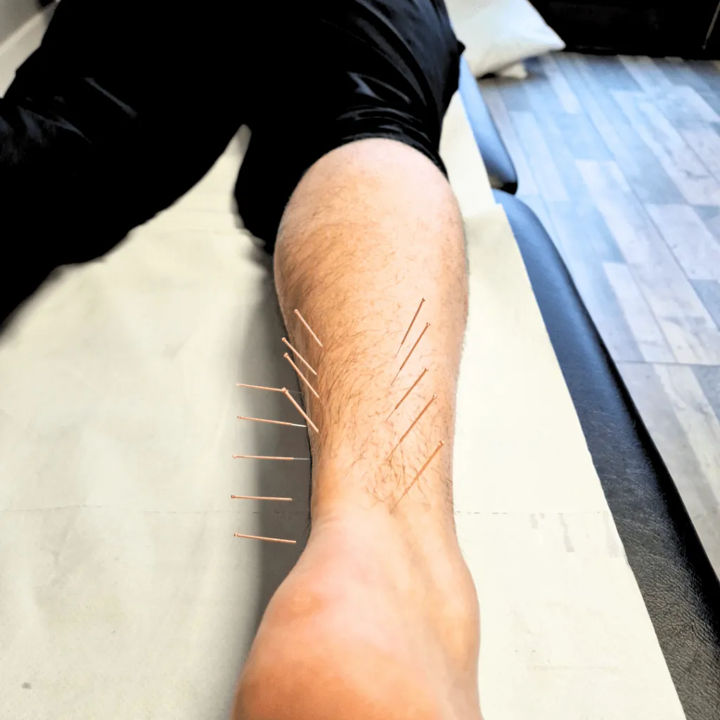 Acupuncture – unlock the benefits! — figure 3
