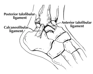ankle sprains