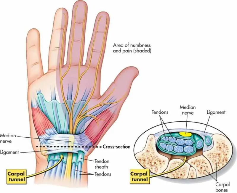carpal tunnel syndrome anatomy