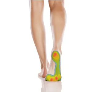 How Footscan Servicing Can Help with Foot and Ankle Pain — figure 2