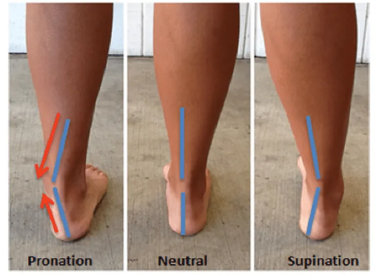 foot pain risk factors