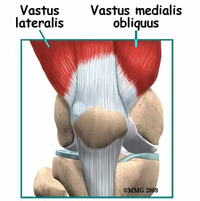 Kneecap / Patella Pain: Can Physiotherapy Help? — figure 3