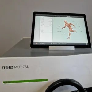 Revolutionizing Plantar Fasciitis Treatment: The Role of Shockwave Therapy — figure 2