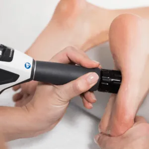 Revolutionizing Plantar Fasciitis Treatment: The Role of Shockwave Therapy — figure 3