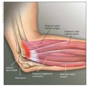 tennis elbow anatomy