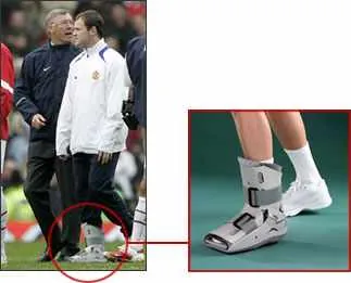 Top Tips on How to Manage an Ankle Sprain — figure 1