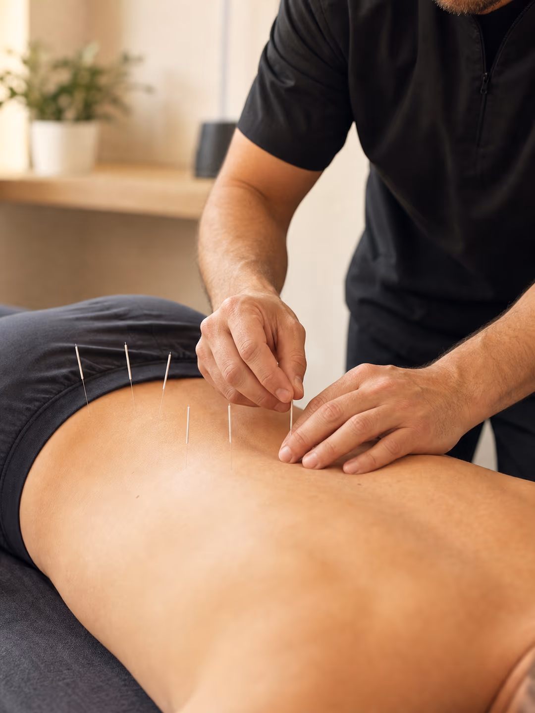Acupuncture treatment session for chronic pain relief