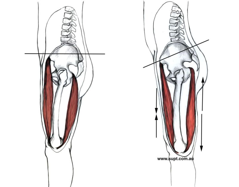 Hamstring Injury In Football The Physio Lounge