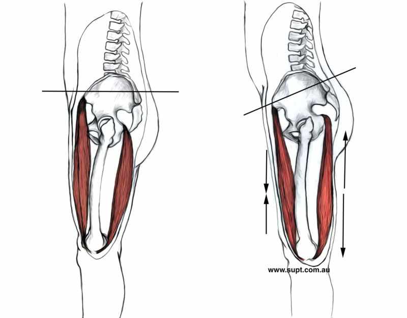 Hamstring Pelvic Tilt