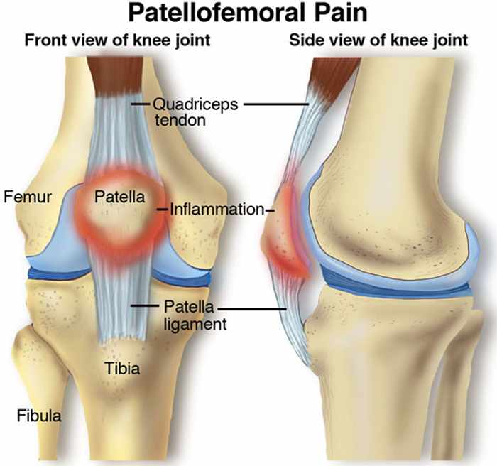 knee pain manchester