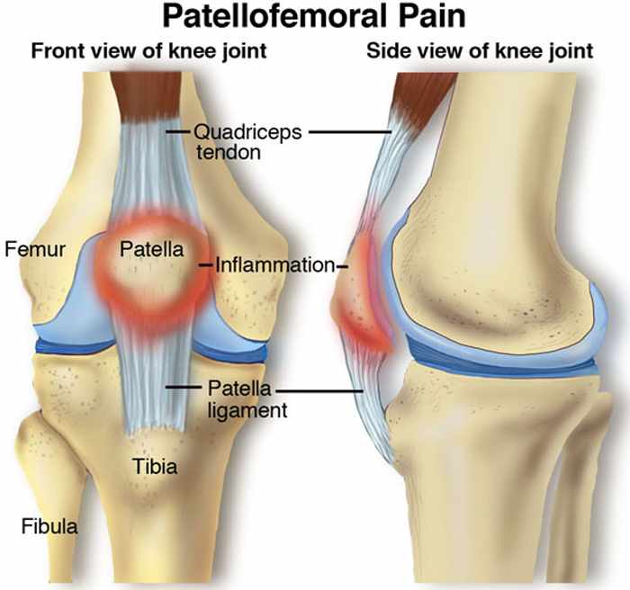 Pain in front of clearance knee under knee cap