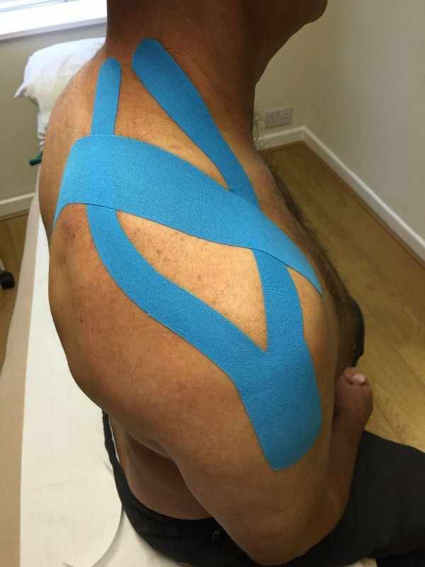 Kinesiology tape for shoulder impingement