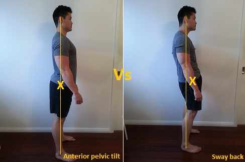 pelvic tilt